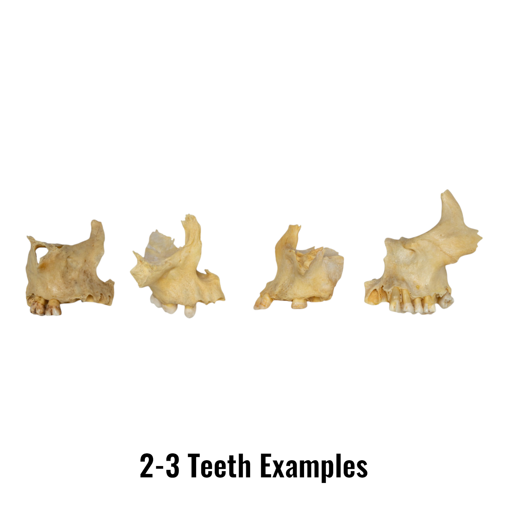 Authentic Human Maxillary Bone - Single Specimen for Medical Study, Dental Education, and Anatomy Research | Ideal for Students, Doctors, and Science Enthusiasts