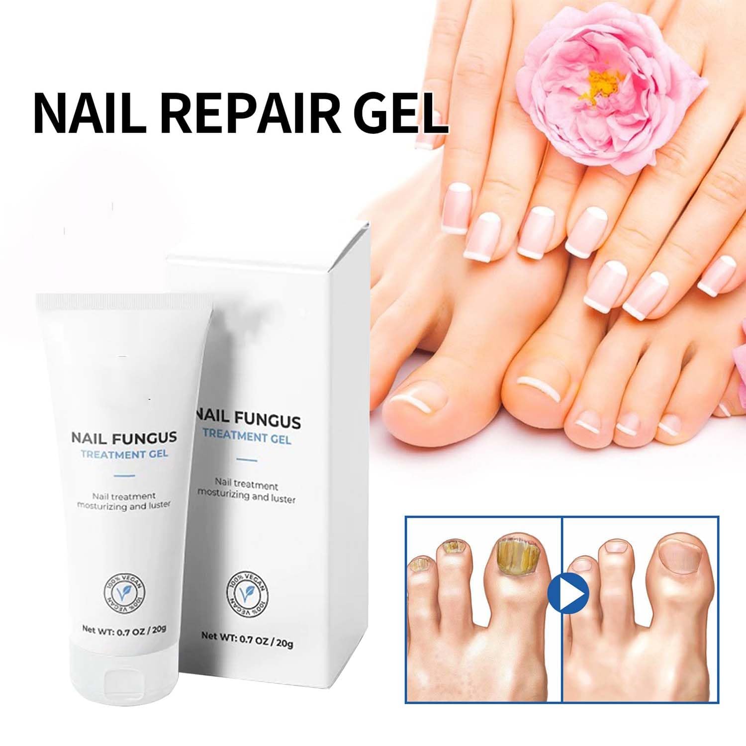Postur Nail Gel - Fungus Treatment & Nail Care for Damaged & Discolored Nails - Strengthens & Restores Healthy Nails - Perfect for Toenail & Fingernail Fungus Treatment at Home (1pc)