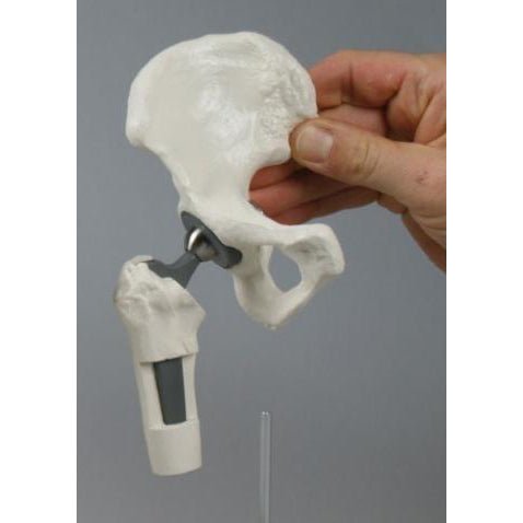 High-Quality Hip Implant Model - Medical Training & Surgical Demonstration Tool for Orthopedic Surgeons & Students