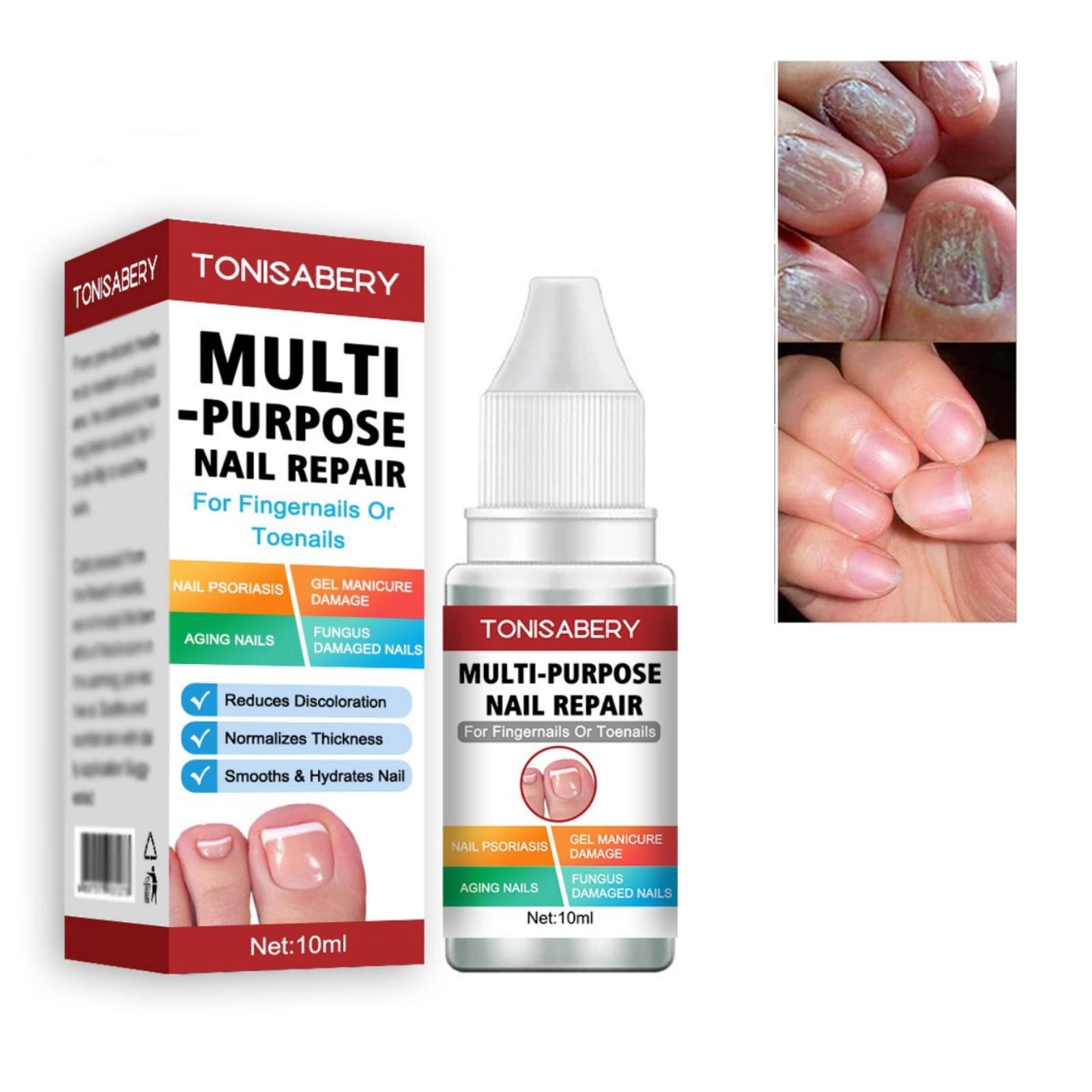 **AINxtolm Extra Strong Antifungal Nail Treatment – Fast-Acting Toenail & Fingernail Fungus Solution for Repair & Care (10ml, Red) – Clinically Proven Formula for Athletes, Swimmers & Daily Foot Hygiene – Best for Gym, Pool, Home, Travel & Sports Use – Ideal for Athlete's Foot, Nail Fungus Prevention & Post-Workout Foot Care**