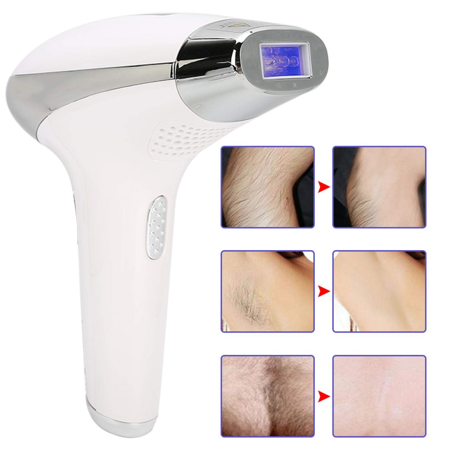 IPL Hair Removal Machine for Face & Body - LCD Display, Adjustable Settings, 110-240V, Silver | At-Home Hair Removal Device for Smooth Skin - Perfect for Legs, Arms, Bikini Line & Underarms