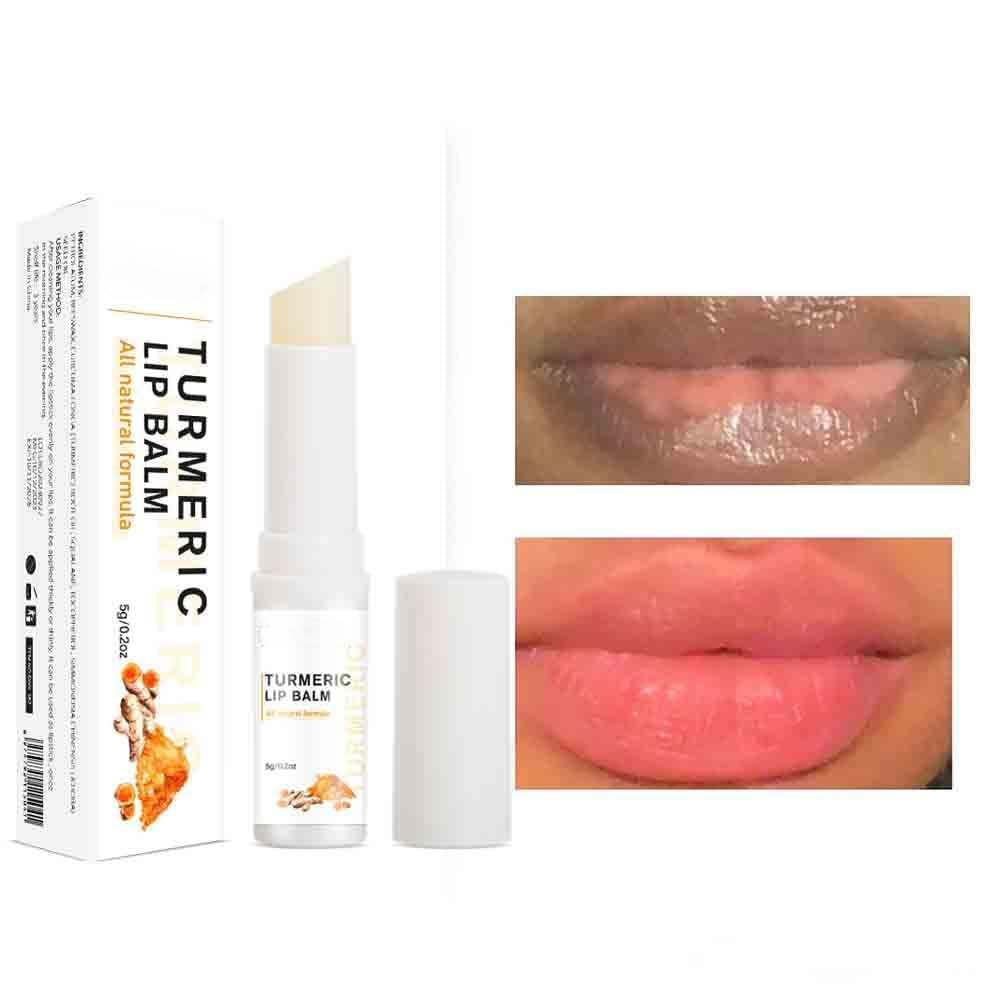 MEXMOB Turmeric Lip Balm - Dark Spot Remover, Whitening & Moisturizing Lip Treatment with Hyaluronic Acid - Exfoliates Dead Skin, Lightens Lips - Perfect for Dry, Chapped Lips & Night Lip Care Routine