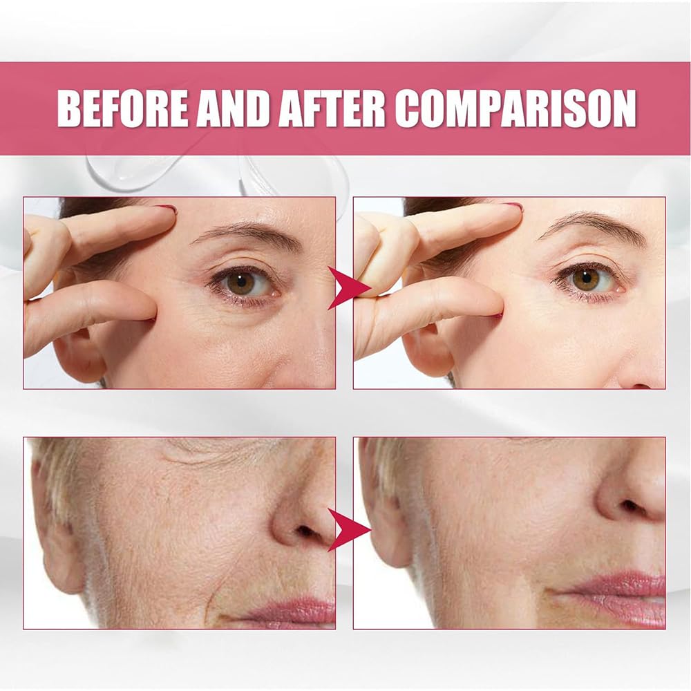 **Sxcs Recombinant Collagen Filling Cream – Anti-Aging Face Cream with Korean Pearl Extract, Wrinkle Reducer & Skin Rejuvenation – Perfect for Daily Hydration & Night Repair (1pc)**    *(Use Case: Ideal for reducing fine lines, plumping skin, and restoring youthful glow – great for both day and night skincare routines.)*