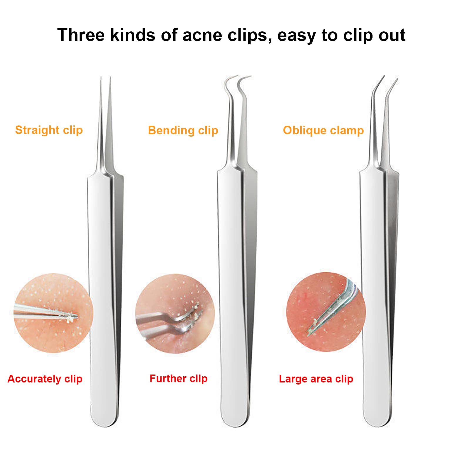 Professional 8-Piece Blackhead Remover Kit - Stainless Steel Pimple Popper & Comedone Extractor for Acne, Whitehead & Blemish Removal - Perfect for Facial Skincare & At-Home Spa Treatments
