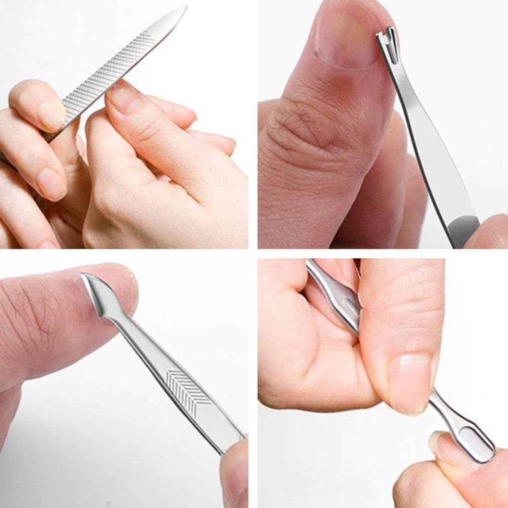10-Piece Professional Manicure Kit for Women & Men - Nail Clippers, Acne Needle, Blackhead Remover Tools | Rose Gold Travel Grooming Set | Perfect Gift for Her & Him | Home, Travel & Salon Use