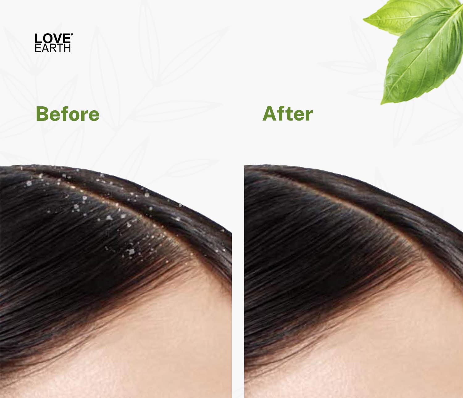 Organic Neem Oil for Skin & Hair - Cold Pressed Virgin Neem Oil for Acne, Pigmentation, Dandruff & Scalp Care | Natural Anti-Inflammatory Treatment for Clear Skin & Healthy Hair | Perfect for Daily Skincare & Haircare Routine