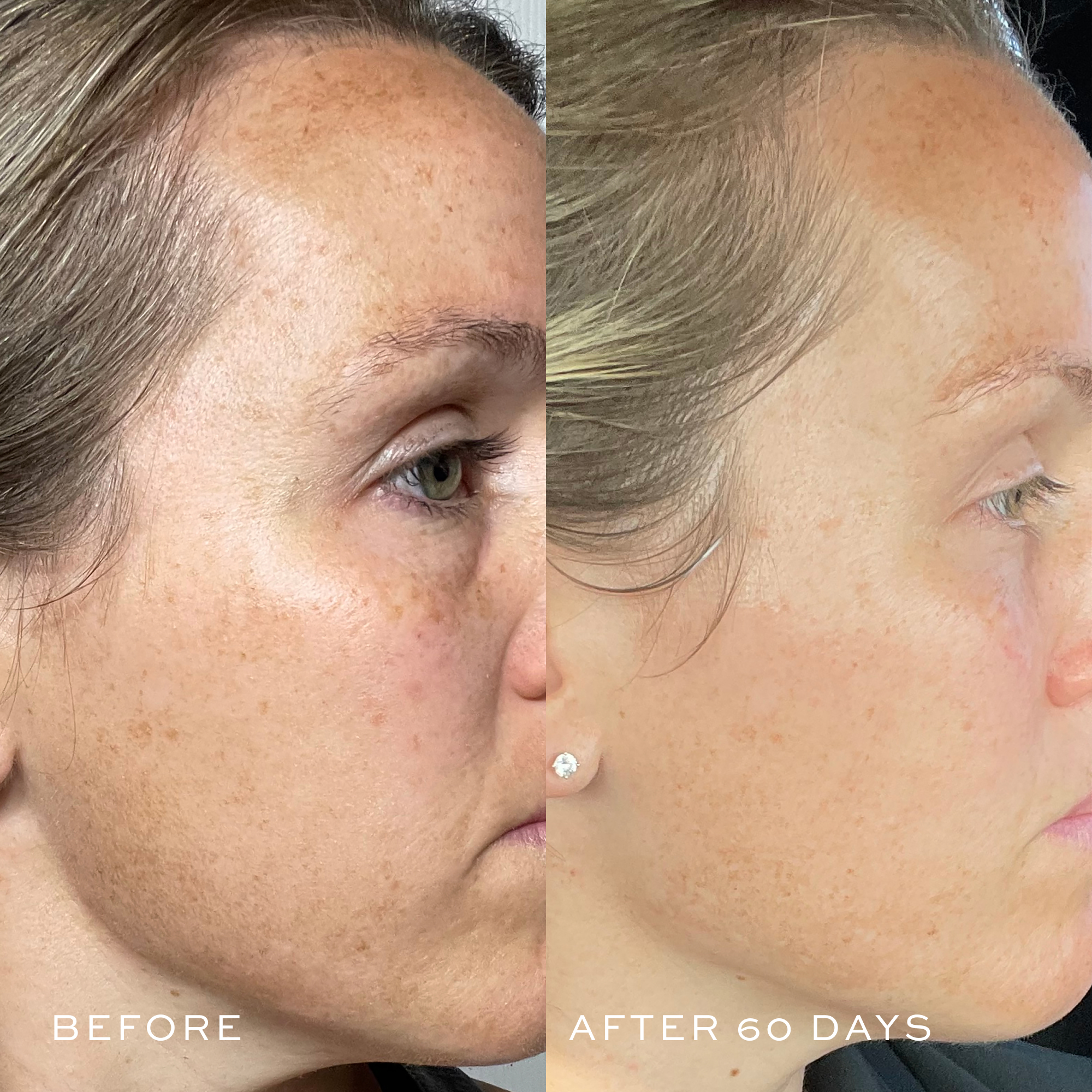 TBT® Reviving Set - Anti-Aging Skincare Kit for Youthful Glow | Perfect for Daily Skincare Routine & Nighttime Regimen