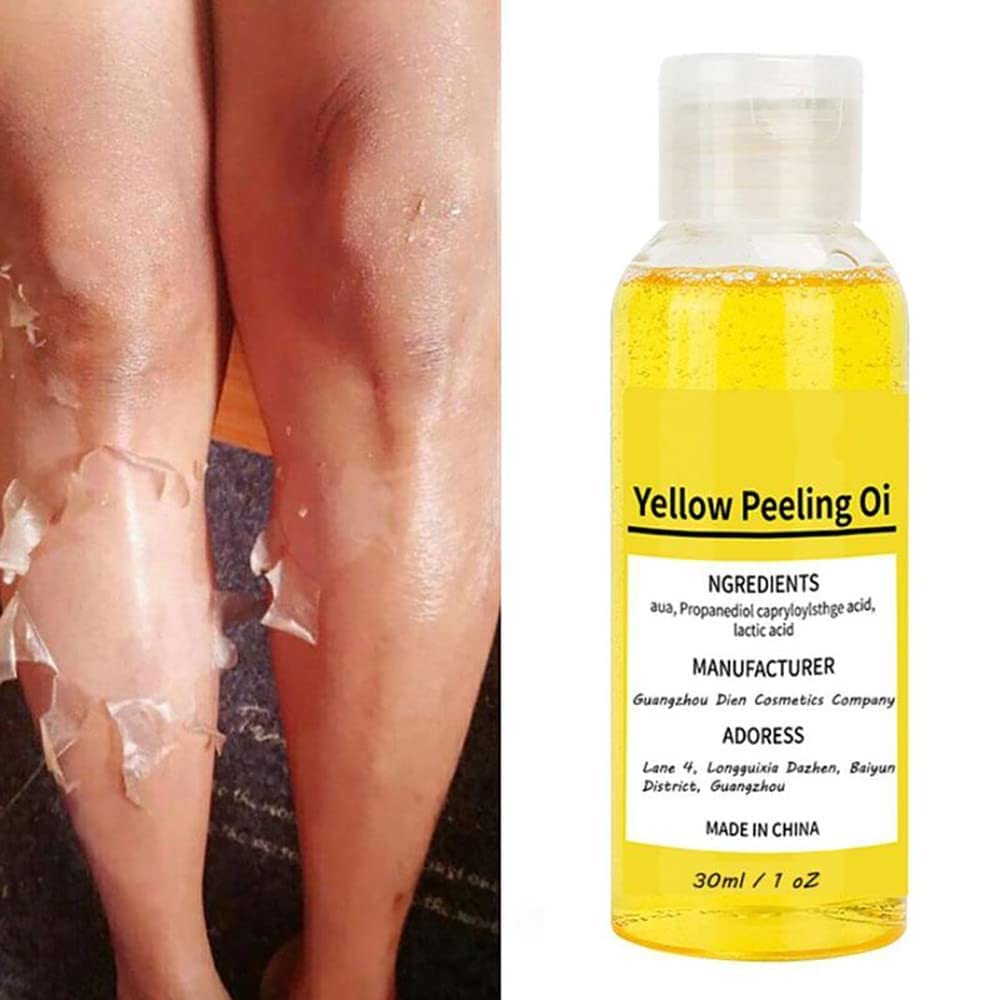 Aumude Super Strength Yellow Peeling Oil - Skin Lightening & Exfoliating Treatment for Dark Spots on Body, Face, Hands & Feet (30ml) | Brighten Skin Tone, Remove Dead Cells & Even Complexion | Perfect for Post-Sun Care, Pre-Wedding Glow & Daily Skincare Routine