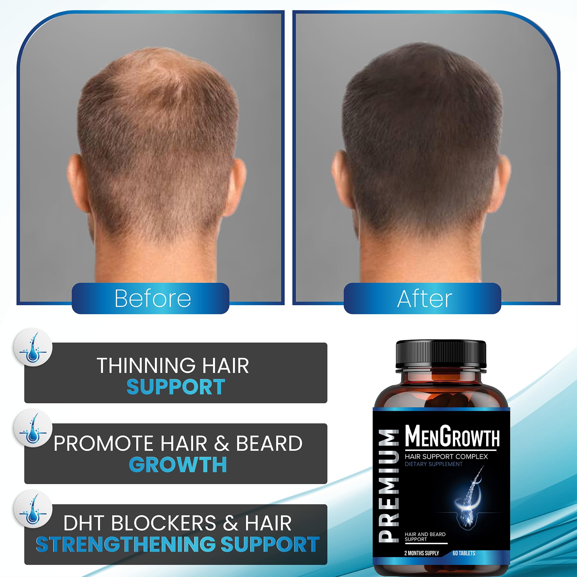 Men's Hair Growth Vitamins - Anti Hair Loss Supplement with DHT Blocker | Biotin & Saw Palmetto for Thinning Hair & Beard Growth | Hair Thickening Pills for Fuller Hair | Perfect for Daily Use & Hair Care Routine