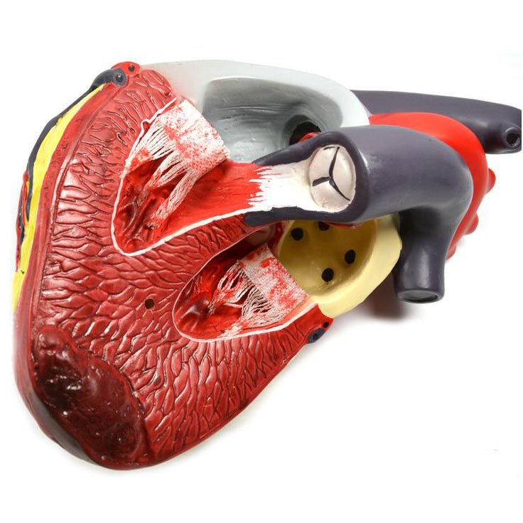 Heart Disease Symptoms, Causes & Treatments - Guide to Cardiovascular Conditions | For Patients & Healthcare Professionals