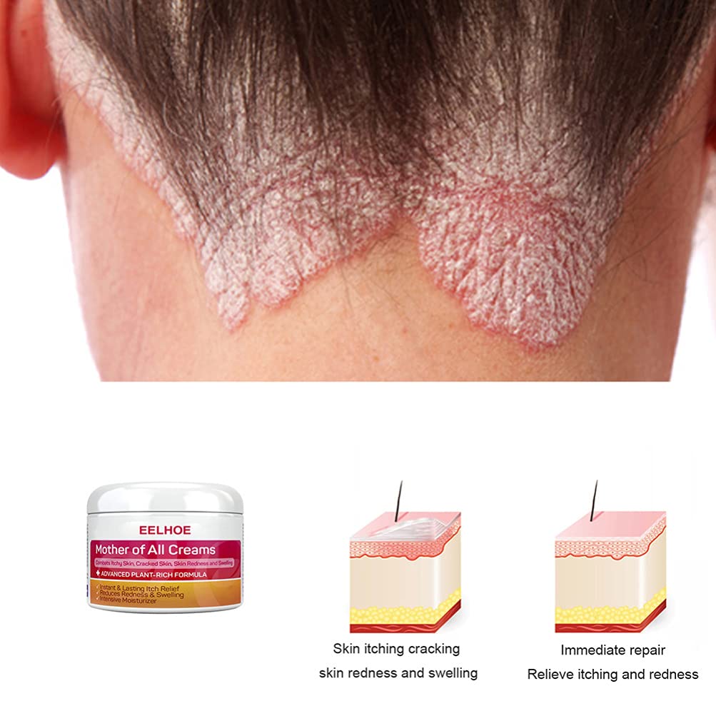 **2 Pack Ultra Hydrating Face & Foot Cream - Intense Moisturizer for Dry, Chapped Skin with Dead Skin Exfoliation - Anti-Drying Body Lotion for Daily Use at Home or Travel**
