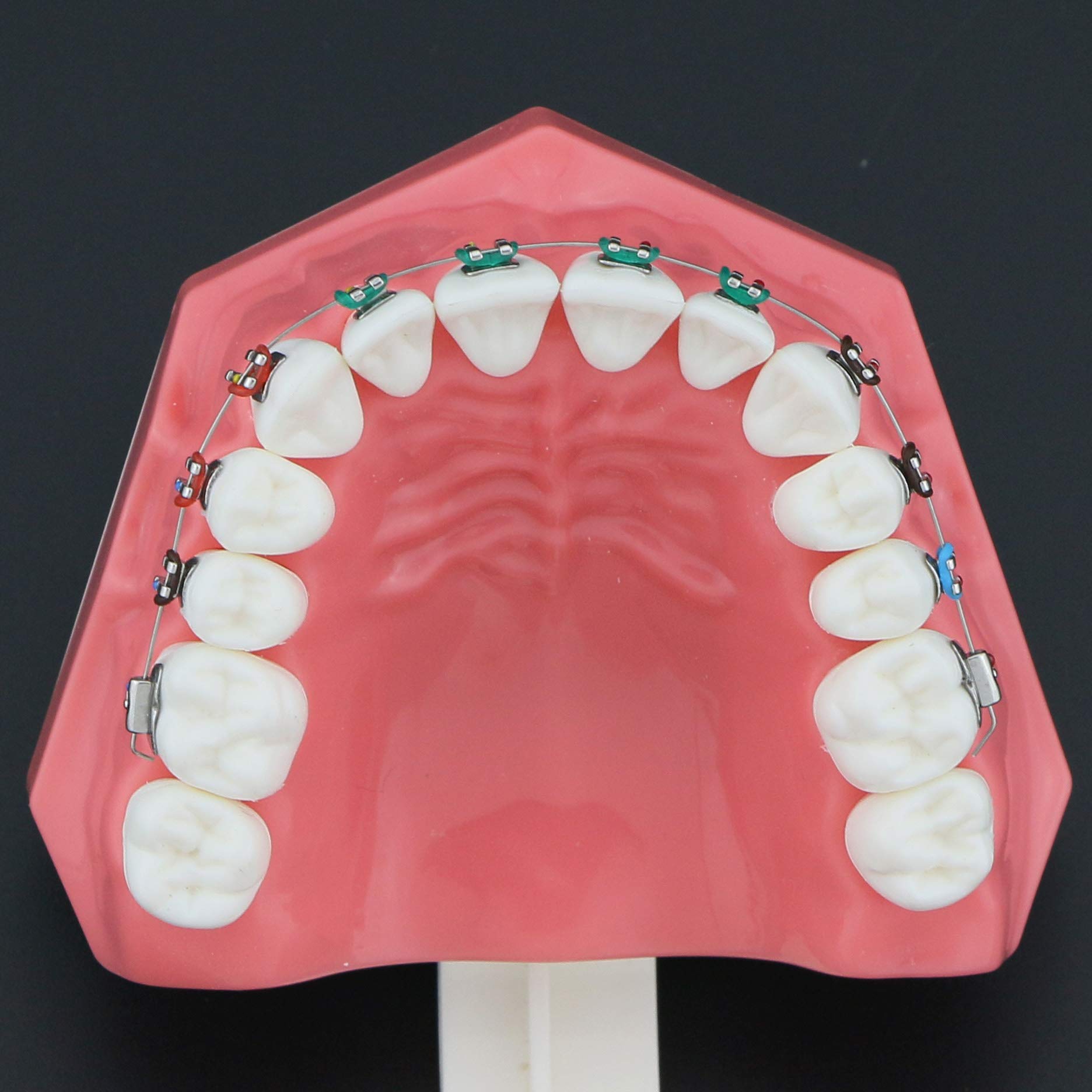 Orthodontic Dental Model with Metal Brackets, Archwires, Tubes & Ligature Ties - Standard Size Teeth Treatment Model for Dental Students & Professionals | Perfect for Teaching, Studying & Clinical Practice