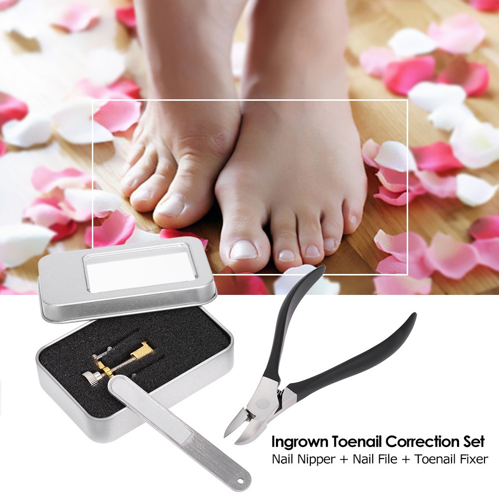 Ubersweet® Ingrown Toenail Correction Kit - Professional Nail Nipper, Cuticle Remover & Nail File for Toenail Treatment - Pedicure Tools for Pain Relief & Nail Care - Perfect for Home Use & Salon Professionals