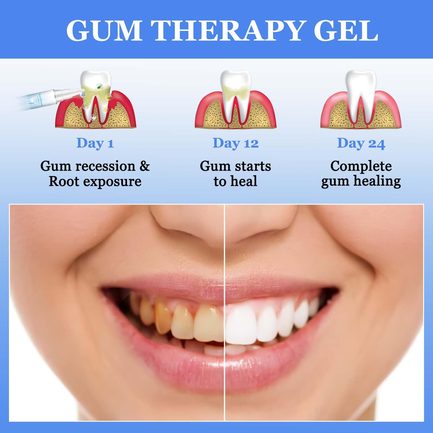 BSOON Gum Therapy Gel - 3 Pack Teeth Whitening Sticks for Sensitive Gums, Stain Remover & Whitening Essence for Brighter Smile | Perfect for Daily Oral Care & Travel Use