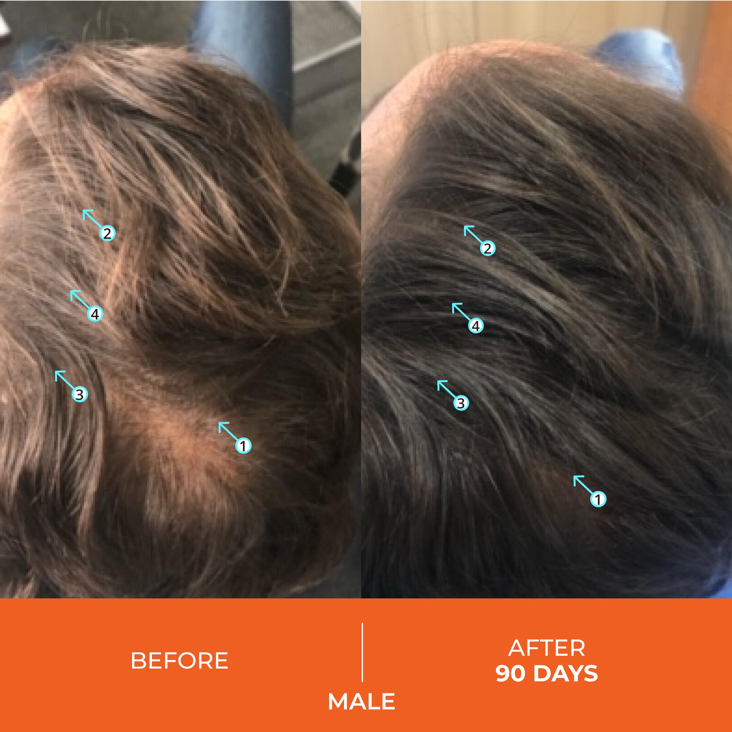 DS Laboratories Revita Shampoo & Conditioner Set for Hair Growth - Sulfate Free with Biotin, Caffeine & DHT Blocker - Thickening Hair Care for Men & Women - Perfect for Thinning Hair & Scalp Health