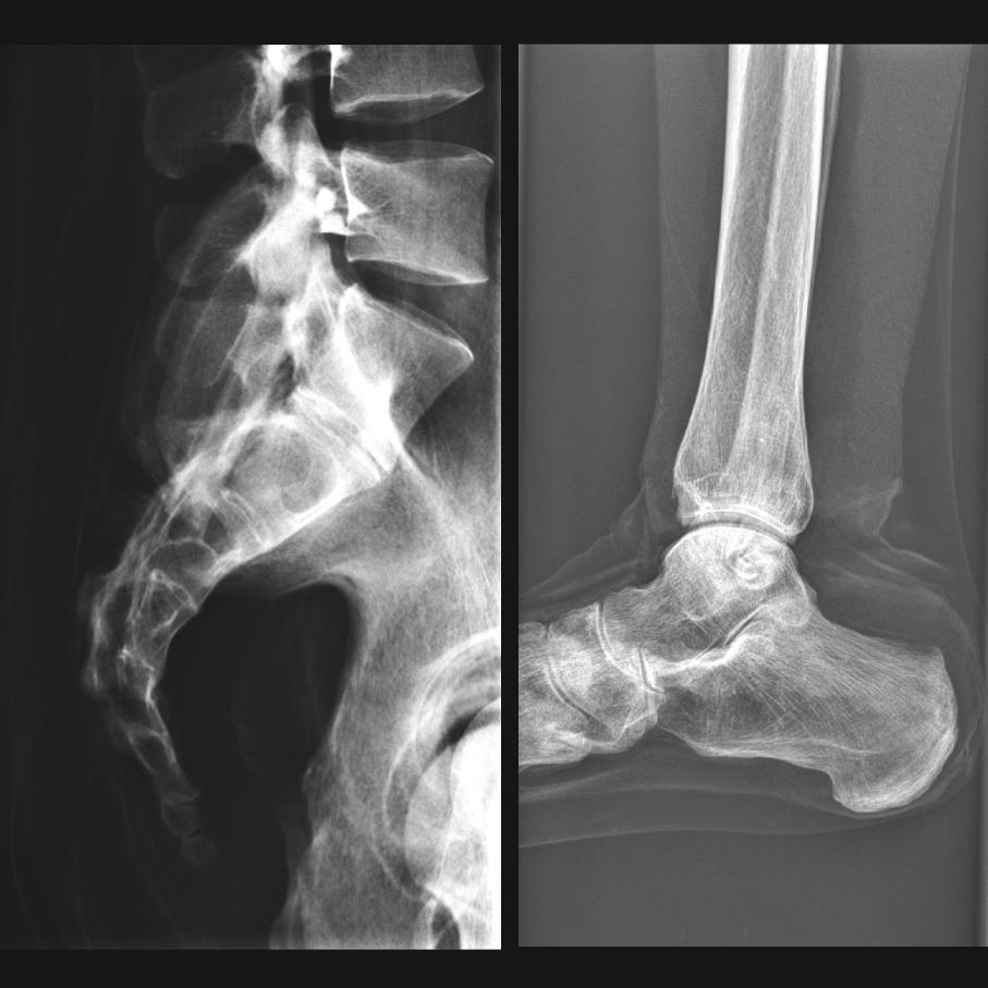 Full Body X-Ray Phantom with Real Human Skeleton Bones - High-Quality Medical Training Model for Radiology, Anatomy Studies & X-Ray Positioning Practice (Ideal for Medical Schools, Hospitals & Research Labs)