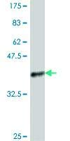 Anti-PSMB3 Mouse Polyclonal Antibody - 50μL for Western Blot & Immunohistochemistry - Research Grade Protein Analysis Reagent