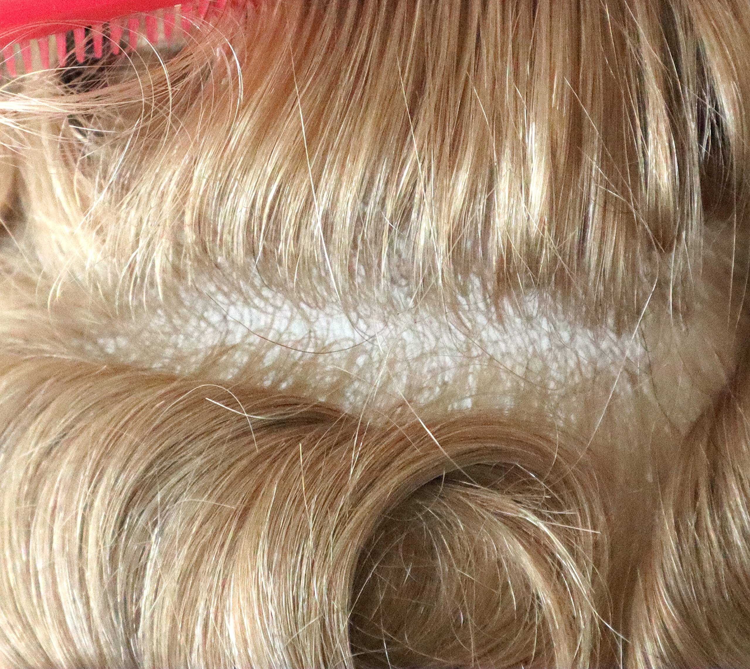 Men's Human Hair Toupee Wig - Real Hair Replacement System with Medium Skin V-Looped Scalloped Front & Natural Hairline (Blonde #22R) - Perfect for Daily Wear, Special Occasions & Hair Loss Solutions