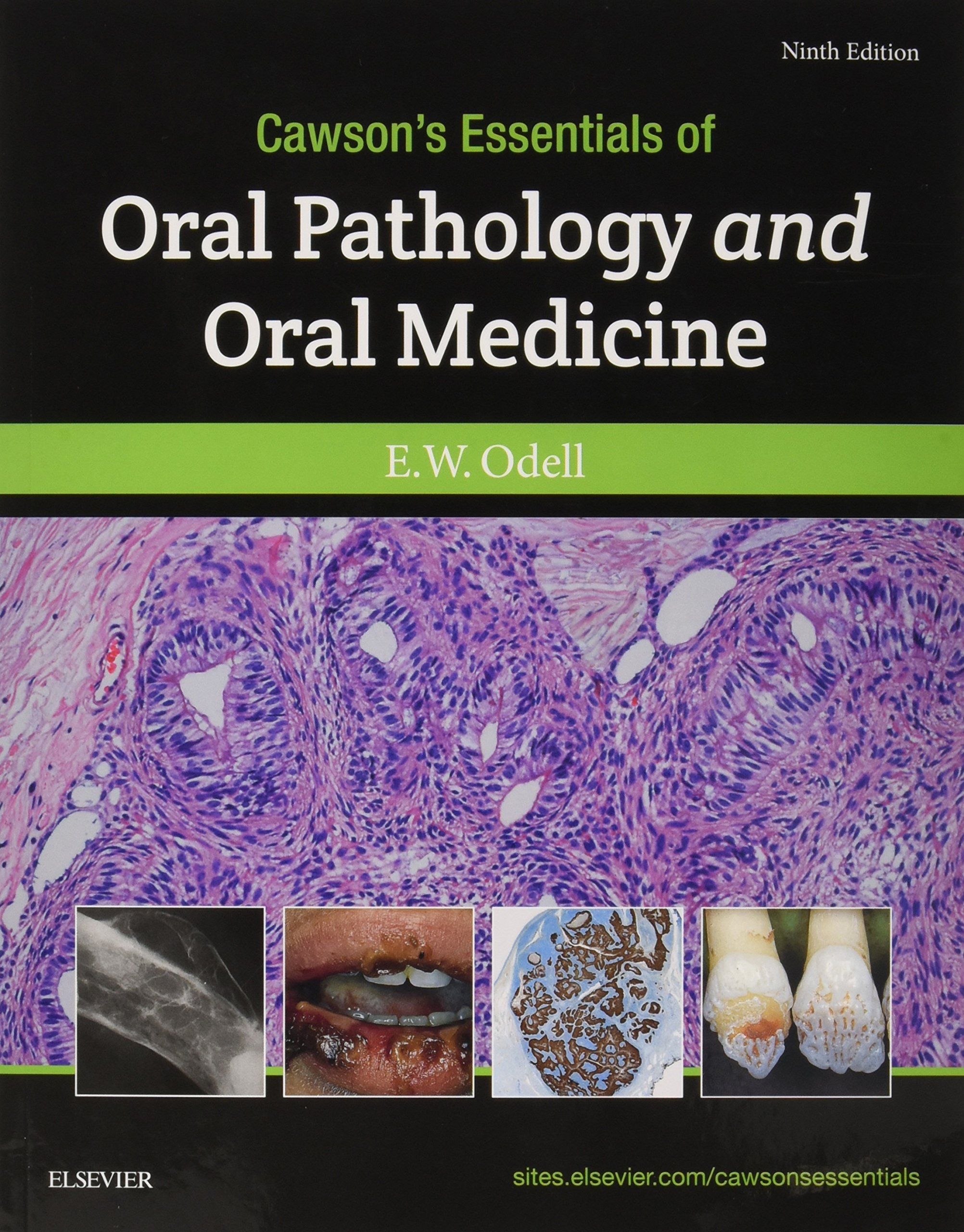 Cawson's Essentials of Oral Pathology and Oral Medicine - Comprehensive Dental Textbook for Students & Professionals - Perfect for Clinical Practice & Exam Preparation