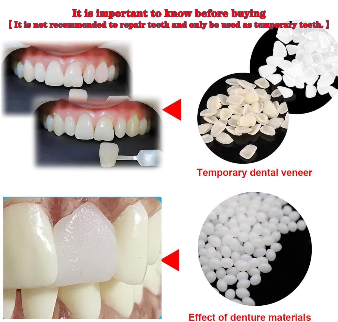 Temporary Tooth Repair Kit - Thermal Fitting Beads & Fake Teeth Replacement (80Pcs, Yellow + White) for Emergency Dental Care, DIY Teeth Whitening & Pain Relief - Perfect for Travel, Camping & Home Use