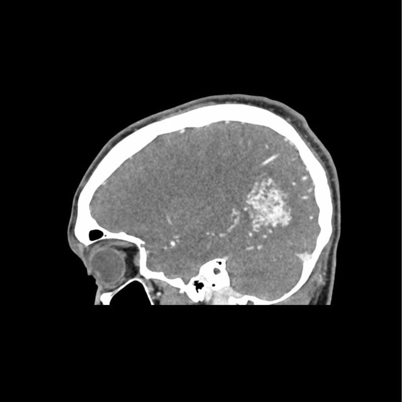 CTA AVM / Lesion Head Phantom - High-Quality CT Scan & X-Ray Training Tool for Medical Students & Radiology Professionals | Perfect for Diagnostic Imaging Practice & Medical Education