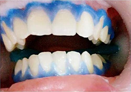 EZGO Teeth Whitening Kit - Cheek Retractor, Dental Gingival Barrier Gel & Anti-Fog Mouth Mirrors Combo for Professional & At-Home Teeth Bleaching | Includes C-Shape Mouth Opener & Gum Protector | Perfect for Dental Procedures, Whitening Treatments & Oral Care