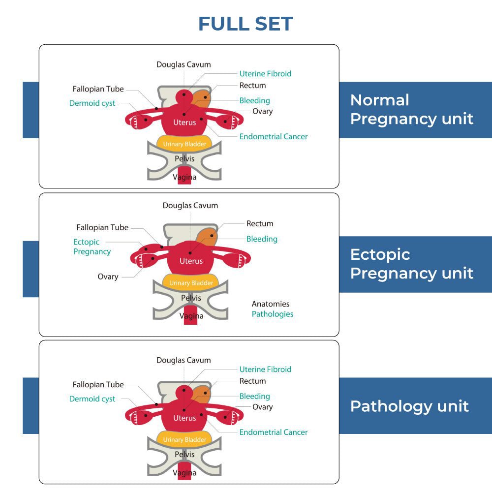 Female Pelvic Ultrasound Phantom - Transvaginal & Transabdominal Training Model for Medical Education - Perfect for OB/GYN Simulation, Sonography Practice & Ultrasound Technician Training