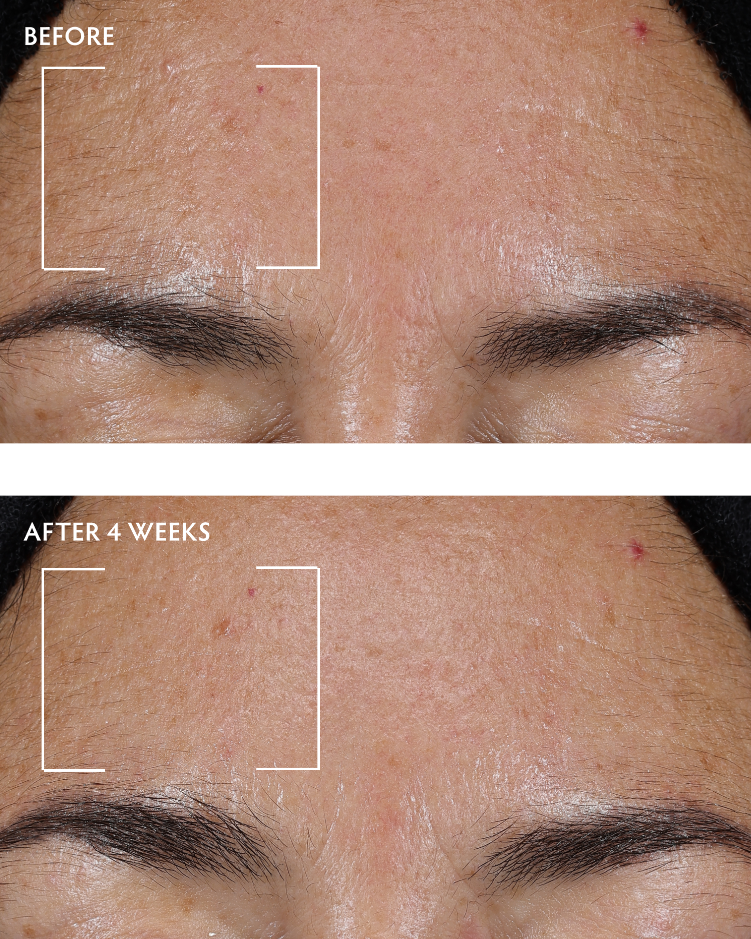 Best Caffeine + Peptide Anti-Aging Face & Neck Serum for Wrinkles & Dark Circles | Brightening & Firming Treatment for Day & Night Use
