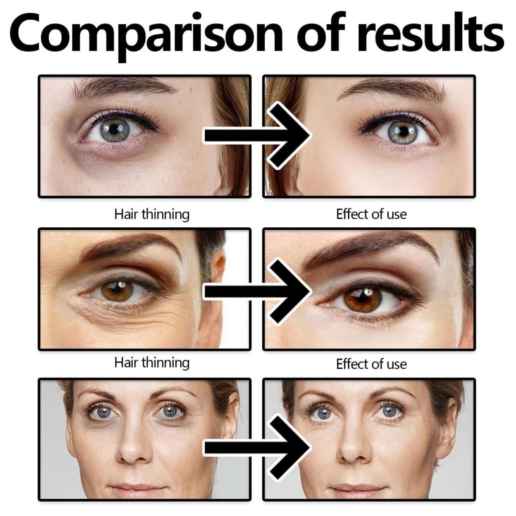 **Anti-Aging Eye Cream for Wrinkles & Dark Circles – Firming Eye Serum for Puffiness & Bags – Rejuvenating Eye Treatment for Men & Women – Instant Eye Lift & Skin Tightening – Perfect for Night Routine & Daily Use (1 Pc)**