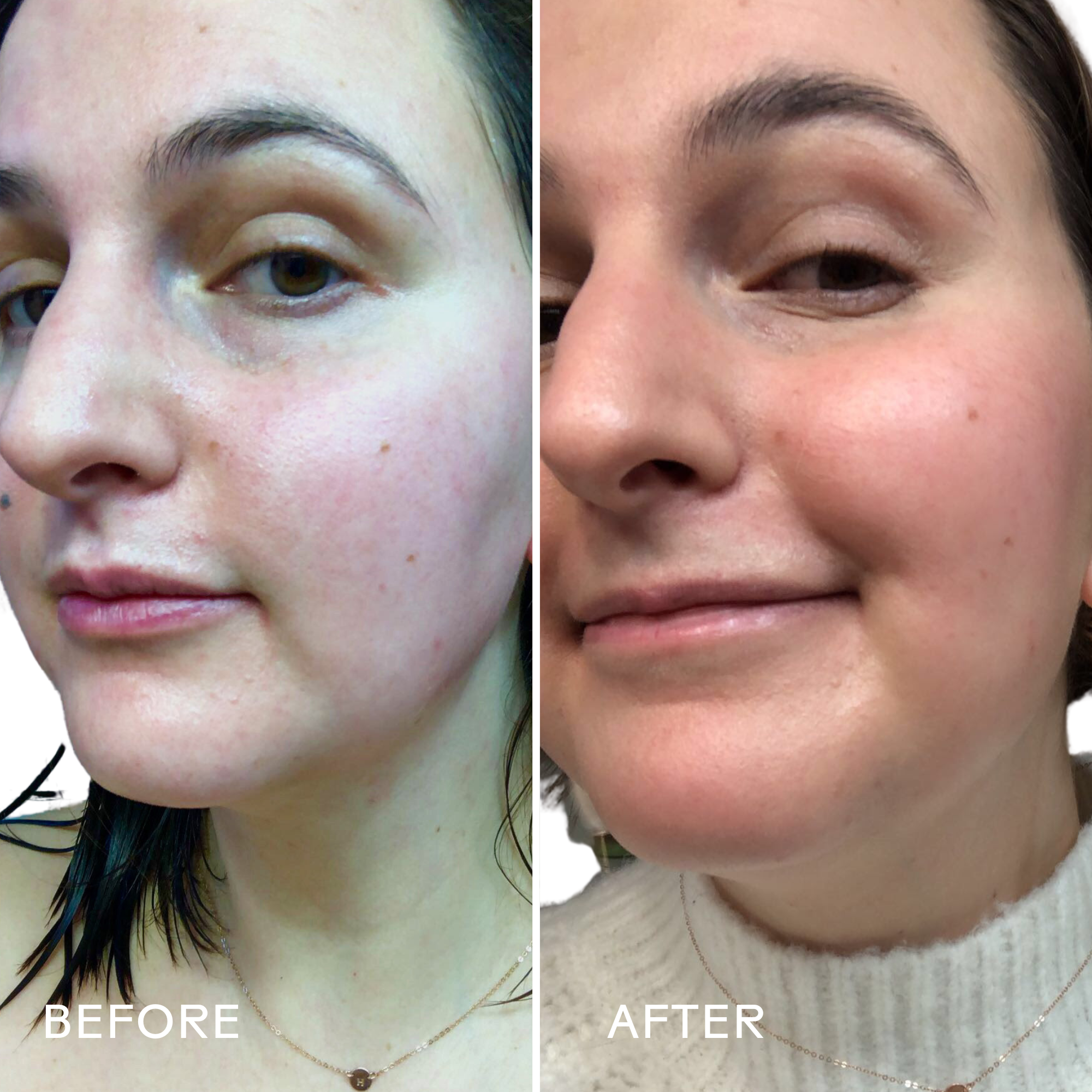 Best Organic Rosehip Oil Serum for Face - 49% Boost Hydration & Anti-Aging - Perfect for Dry Skin & Night Care Routine