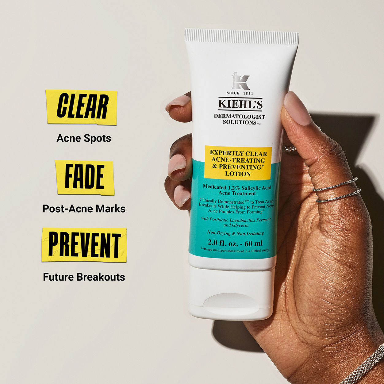 Best Acne Treatment Lotion for Clear Skin - Expert Formula to Prevent & Treat Breakouts | Perfect for Daily Skincare Routine & Oily Skin Care