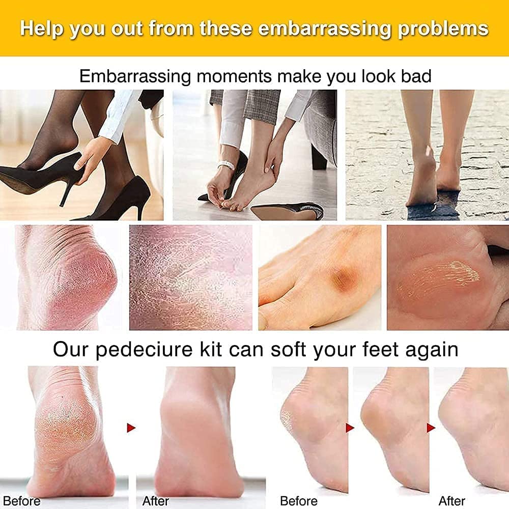**ELITEWAVE 8-in-1 Pedicure Kit – Dead Skin Callus Remover, Foot Scrubber, Foot File & Nail Repair Tool – Perfect for At-Home Spa & Professional Pedicures**