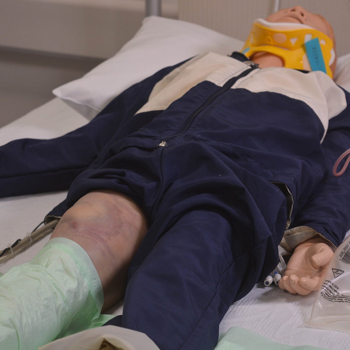Fracture Closed Small - Medical Splint & Cast for Broken Bones - Ideal for First Aid, Emergency Care & Sports Injuries