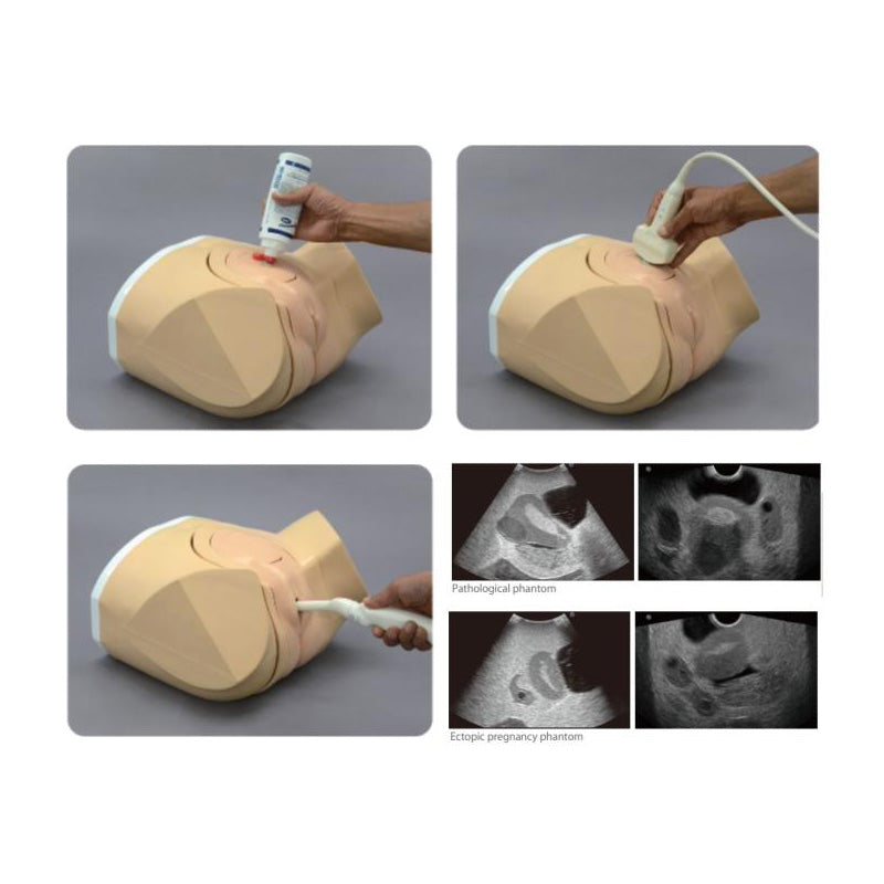 Female Pelvic Ultrasound Phantom for Transvaginal & Transabdominal Training - Gynecology Medical Simulation Model for Sonography Practice & Clinical Skills Development
