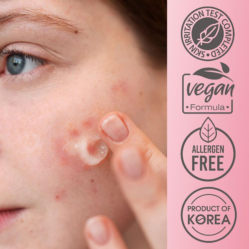 Purederm Blemish Spot Treatment Gel with 2% Salicylic Acid - Soothing Acne Care for Irritated Skin - Day & Night Use - 20ml - Perfect for Teen & Adult Acne, Breakouts & Sensitive Skin Care