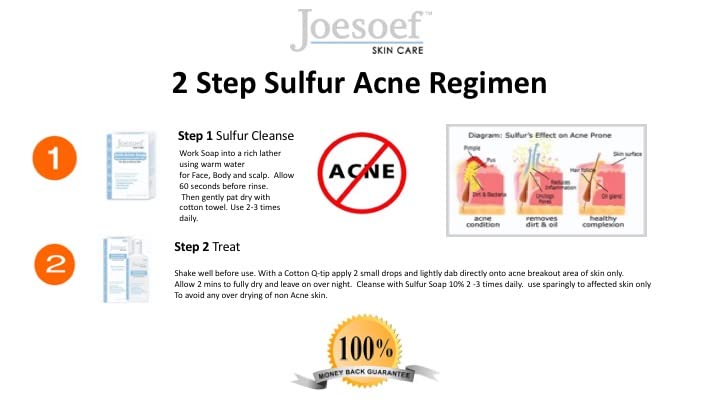 JOESOEF Sulfur Soap for Acne Treatment - 100g Facial Cleanser with Sulfur for Acne-Prone Skin (4-Pack) | Helps Clear Breakouts & Blackheads - Ideal for Daily Face Wash & Body Care