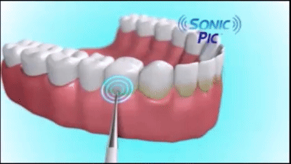 Sonic Pic - Professional Sonic Electric Toothbrush with 6 Brush Heads for Deep Cleaning, Whitening & Gum Care - Perfect for Travel, Home & Office Use