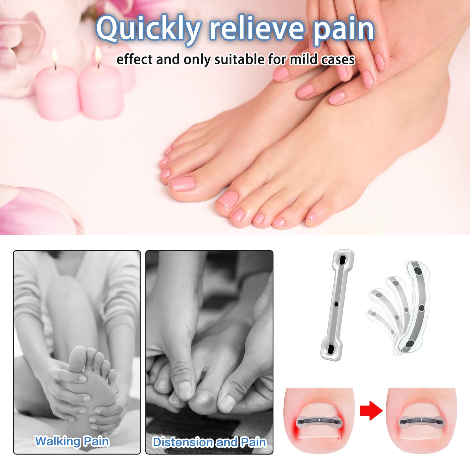 Professional Ingrown Toenail Removal Kit - Titanium Alloy Toenail Corrector Tool for Pain Relief & Home Treatment (0.75-0.82 Inch) - Perfect for Athletes, Runners & Daily Foot Care