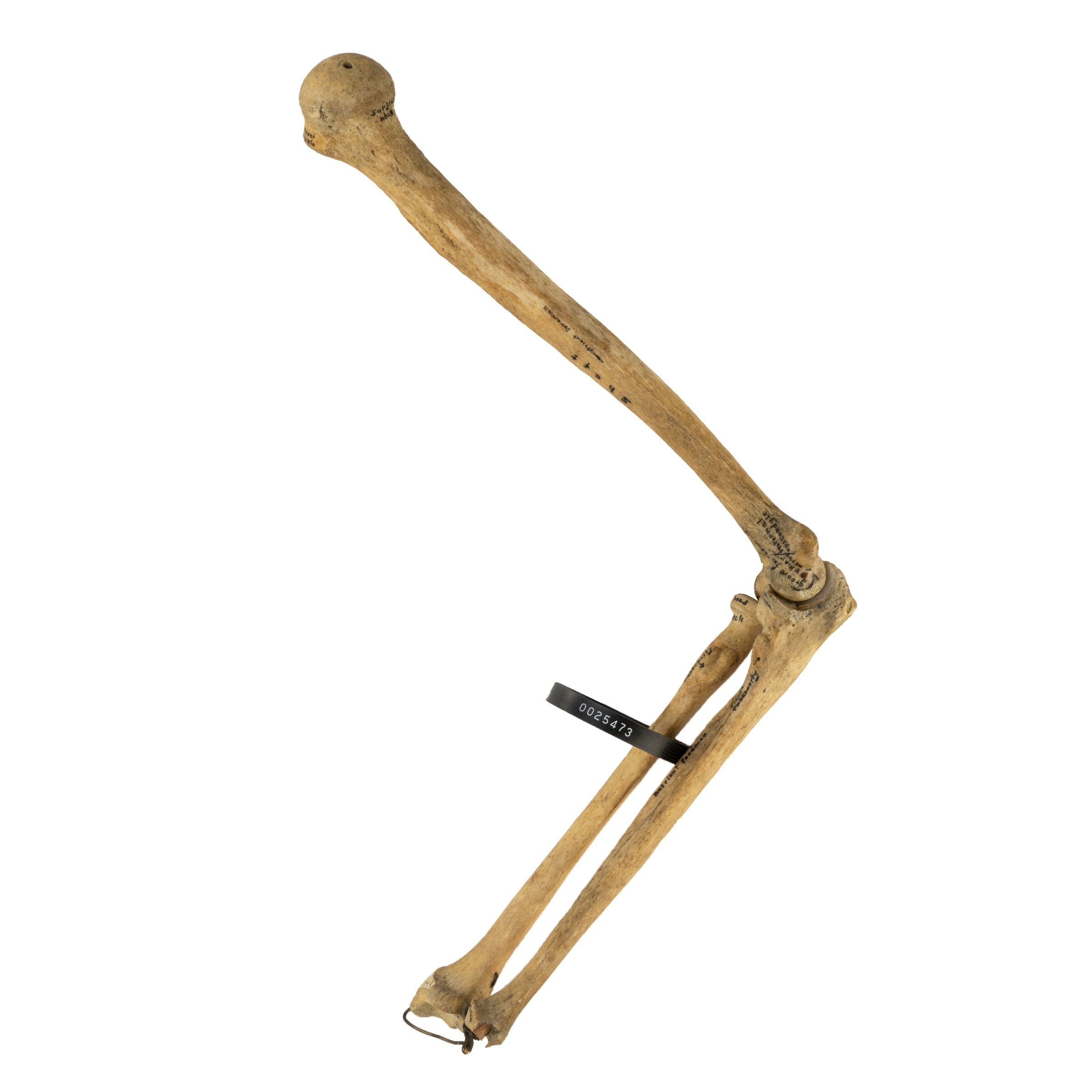 Authentic Human Humerus, Radius & Ulna Bones - Medical Study, Anatomy Education & Science Classroom Specimen