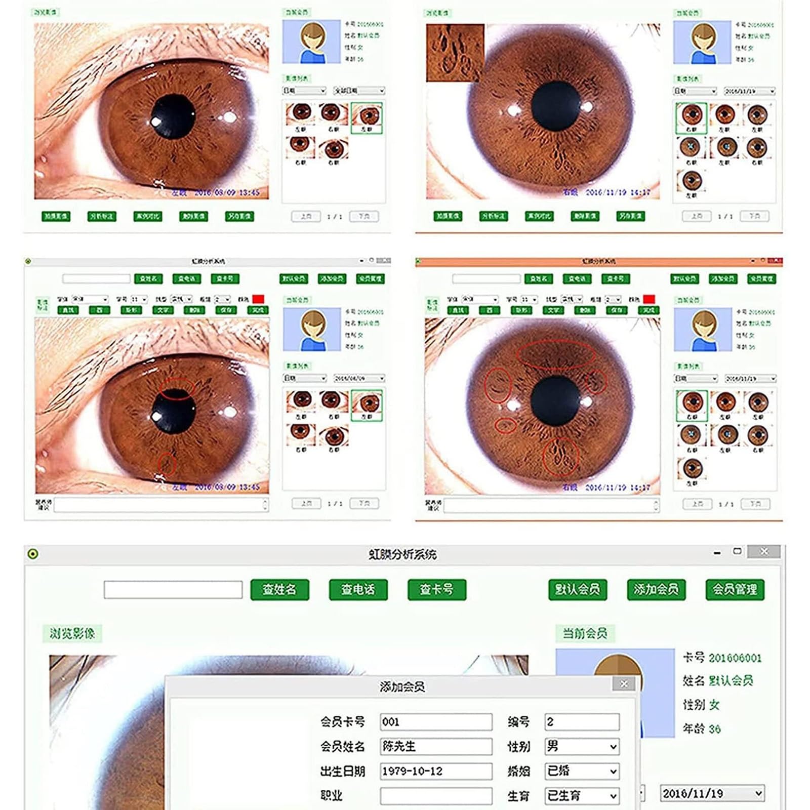 Professional Iridology Camera USB 2.0 with 30x Lens - Portable Left/Right Eye Analyzer for Holistic Health Assessment - Perfect for Naturopaths, Iridologists & Wellness Practitioners