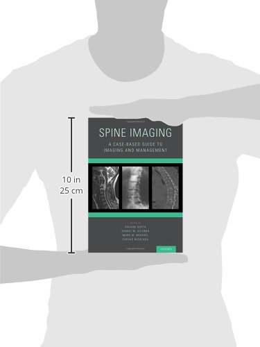 Spine Imaging Guide: Case-Based Radiology & Management for Doctors - Essential for Diagnostics & Treatment Planning