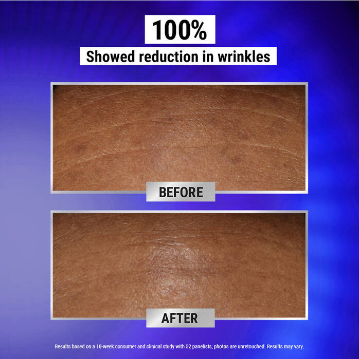 Fast-Acting 0.3% Retinol Night Serum for Wrinkle Reduction - Anti-Aging Face Treatment for Smooth Skin | Perfect for Nighttime Skincare Routine & Dark Spot Correction