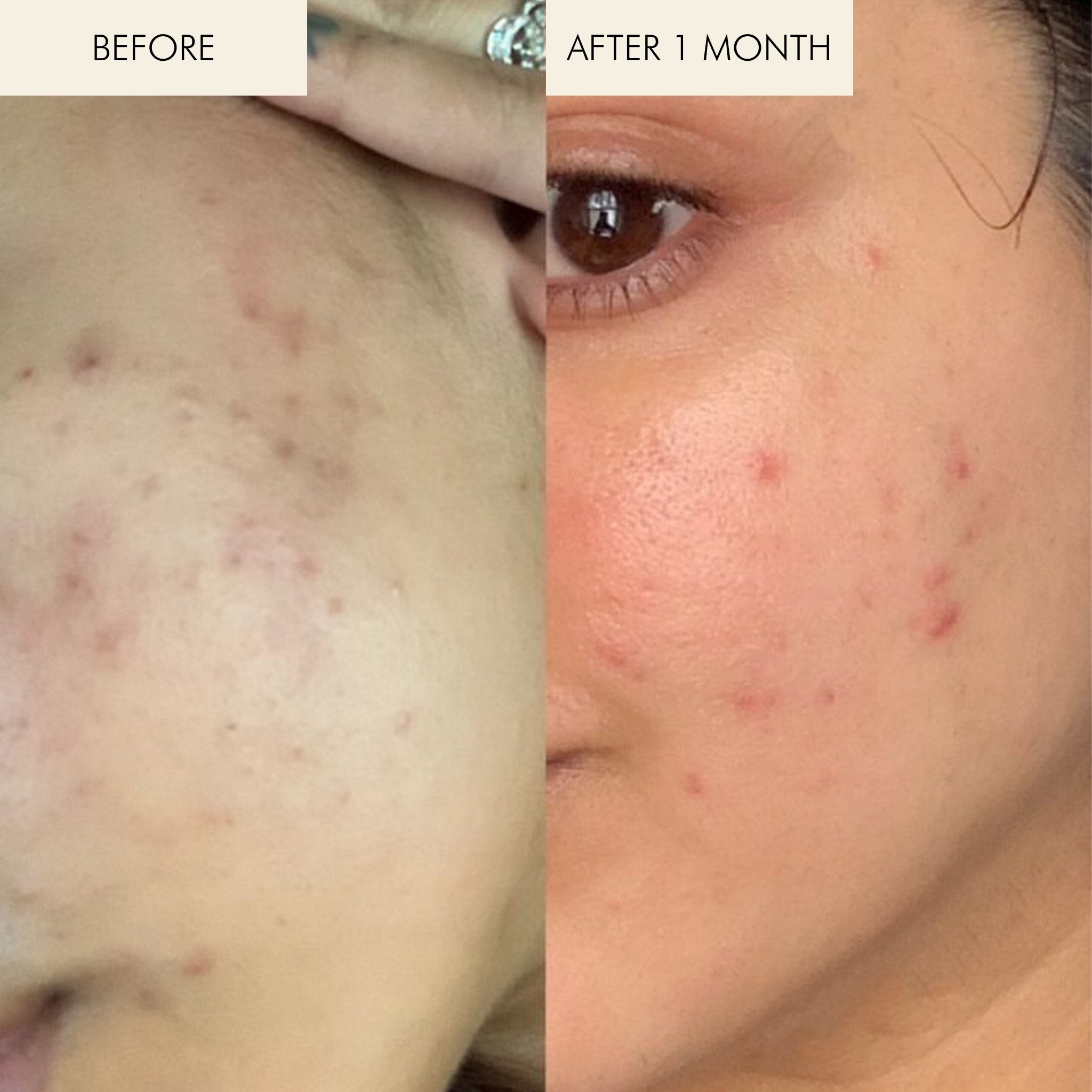 Best Vitamin C Serum for Face - Brightening & Anti-Aging Facial Treatment - Day & Night Skincare for Glowing Skin