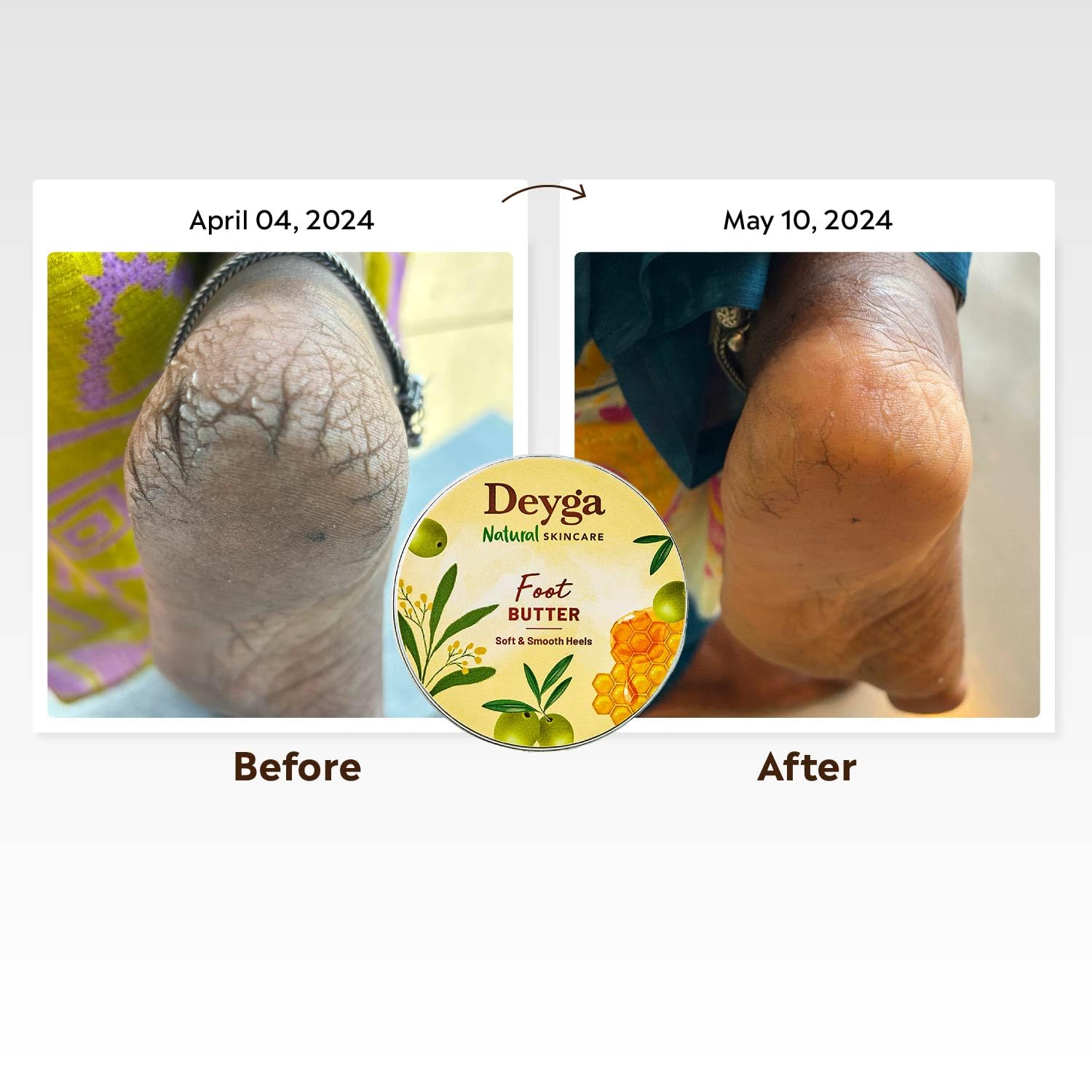 Deyga Foot Cream for Dry & Cracked Feet - Deep Moisturizing Foot Butter for Men & Women - Heel Repair Treatment for Rough Skin - Anti-Wrinkle Foot Care (10g) - Perfect for Pedicures, Daily Foot Care & Cracked Heel Relief