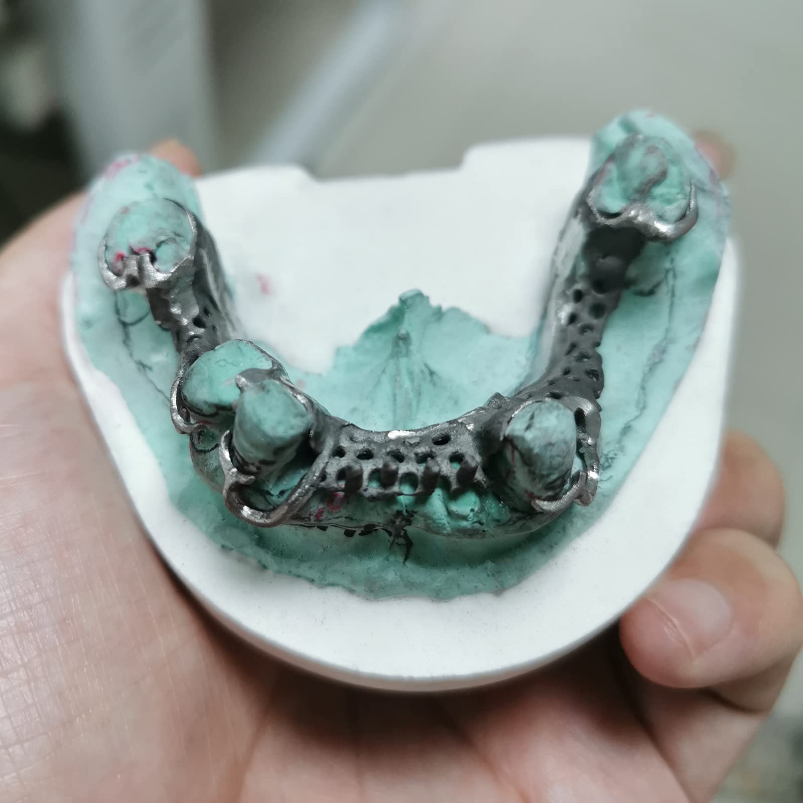 RESIONE C01 High Precision Clear Castable Dental Resin for 3D Printing - Perfect for Crowns, Bridges & Dental Brackets - Ideal for Dental Labs & Orthodontic Applications