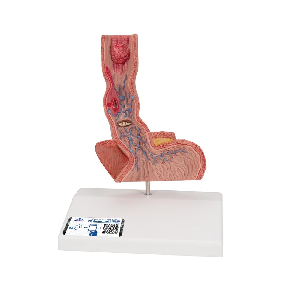 Human Esophagus Anatomy Model - Detailed Medical Teaching Tool for Digestive System Study | Ideal for Students, Doctors & Healthcare Professionals