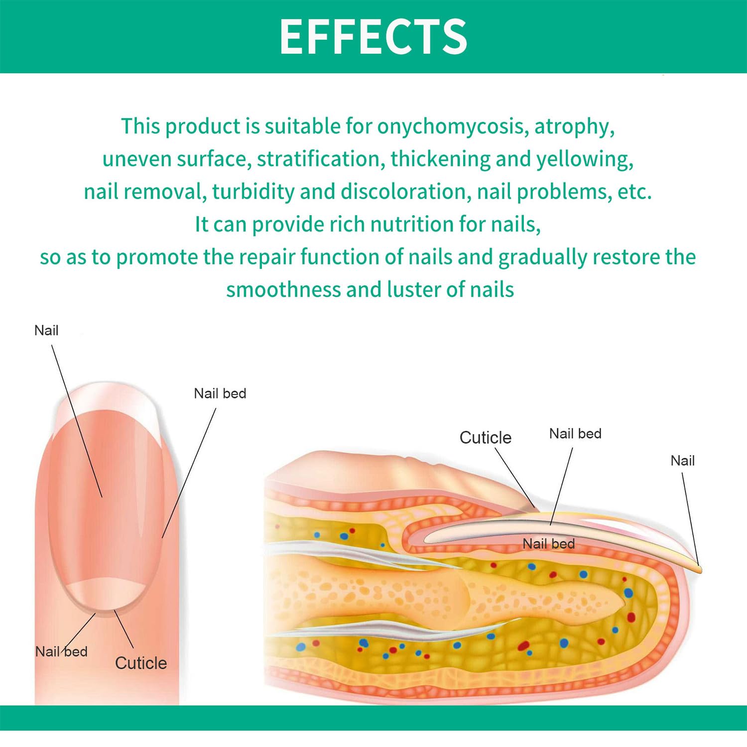 Metanail Extra Strength Toenail Treatment - Repair Damaged & Discolored Nails | Fungal Nail Growth Solution for Healthy Feet | Perfect for Athletes & Daily Foot Care