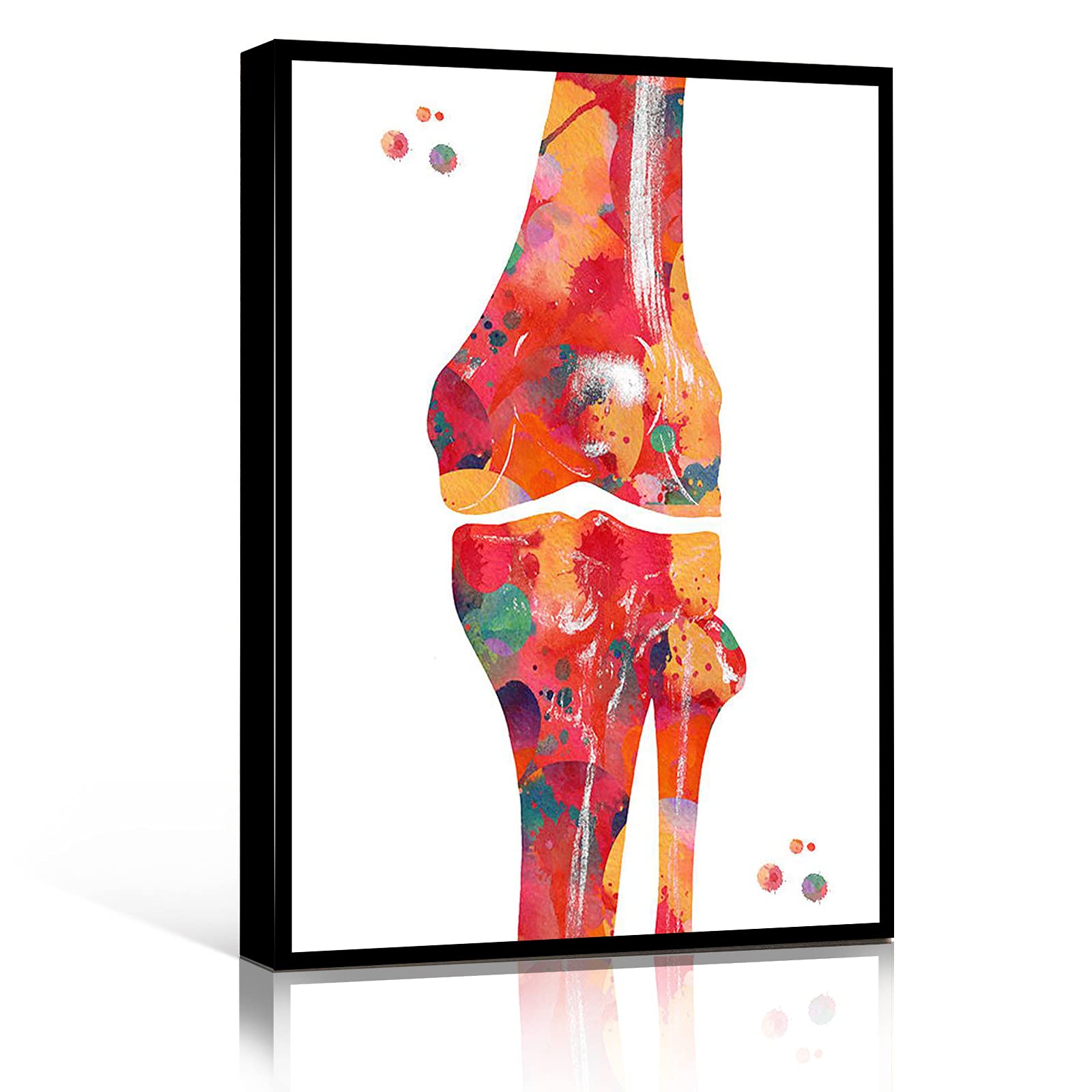 Orthopedic Knee Anatomy Art Print - 12''x18'' Wood Framed Canvas Wall Decor | Medical Skeletal System Poster, Pharmacy & Physical Therapy Office Decor | Perfect for Clinics, Hospitals & Home Offices