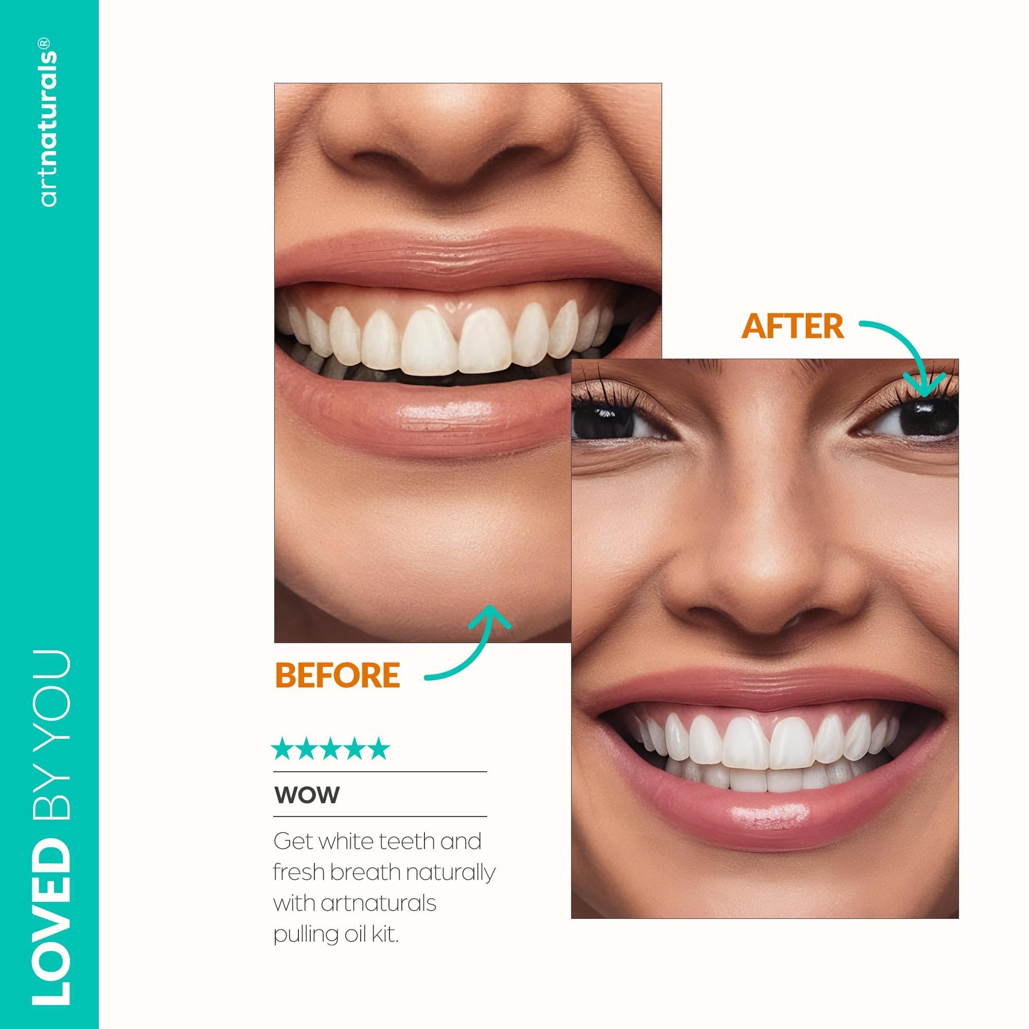 **ArtNaturals Organic Coconut Oil Pulling Kit (8oz) - Alcohol-Free Mouthwash with Magnesium & Peppermint for Teeth Whitening, Fresh Breath & Healthy Gums - Includes Tongue Scraper & Toothbrush Set - Perfect for Daily Oral Care & Natural Whitening Routine**