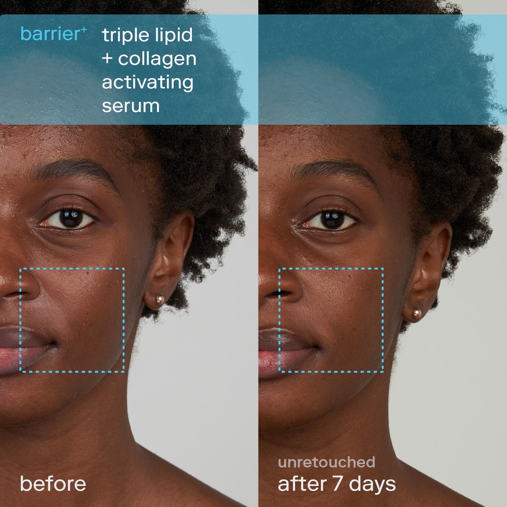 Barrier+ Triple Lipid Activating Serum for Face - Anti-Aging Hydrating Facial Treatment - Day & Night Moisturizer for Dry, Sensitive Skin | Perfect for Daily Skincare Routine & Post-Procedure Care